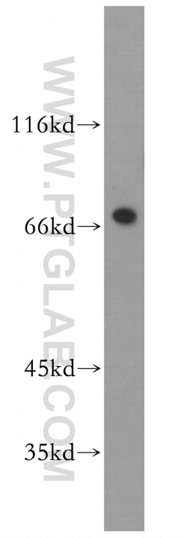 PABPC1/PABP Antibody in Western Blot (WB)