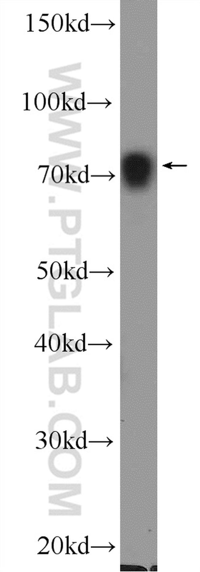 PABPC1/PABP Antibody in Western Blot (WB)