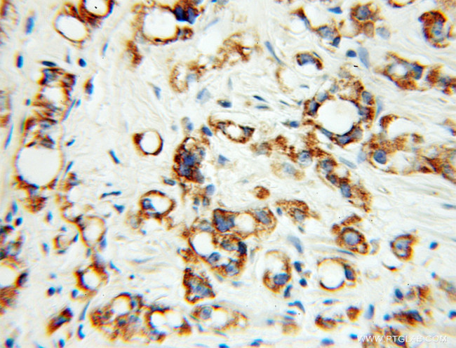 Fc epsilon RI alpha Antibody in Immunohistochemistry (Paraffin) (IHC (P))