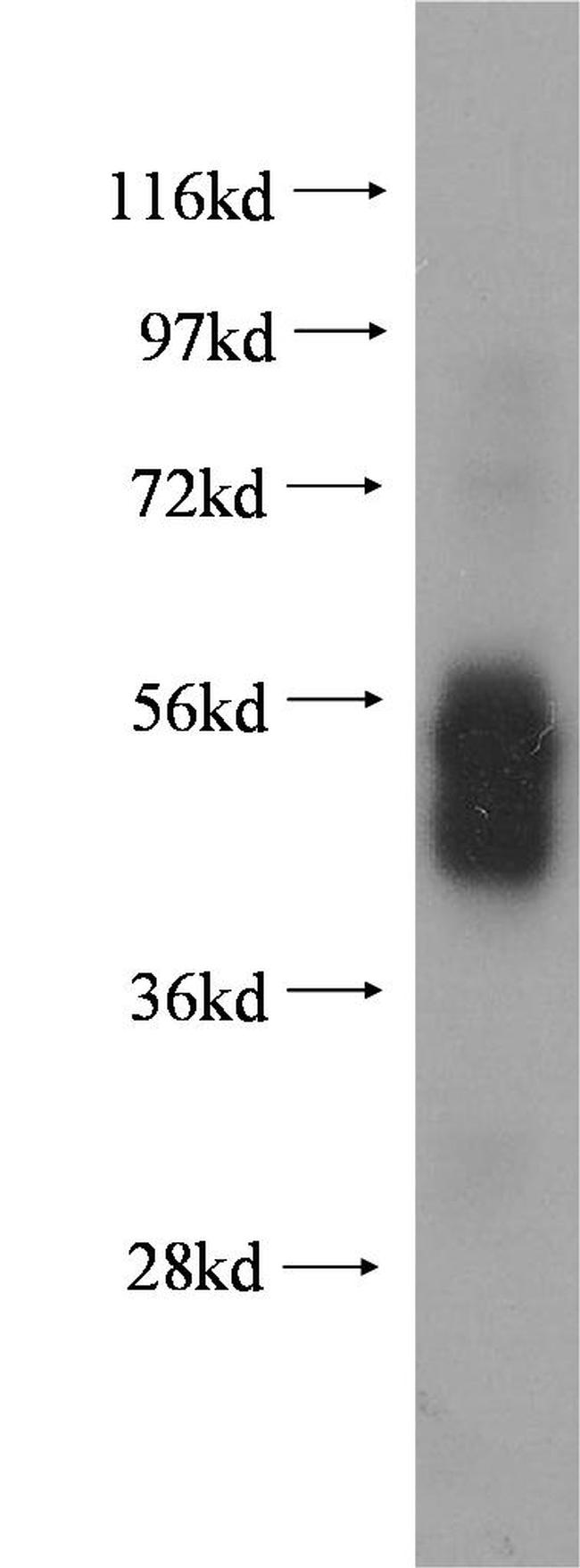 Fc epsilon RI alpha Antibody in Western Blot (WB)