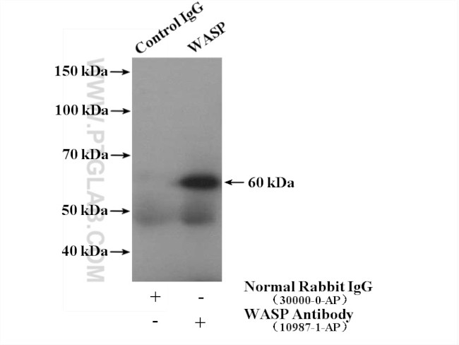 WASP Antibody in Immunoprecipitation (IP)