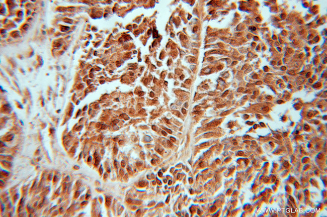 FHL1 Antibody in Immunohistochemistry (Paraffin) (IHC (P))