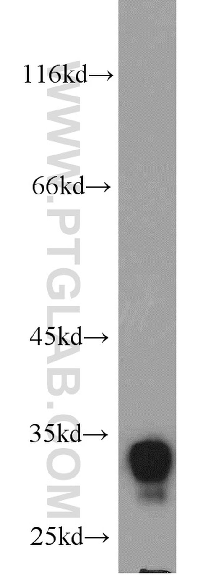 FHL1 Antibody in Western Blot (WB)