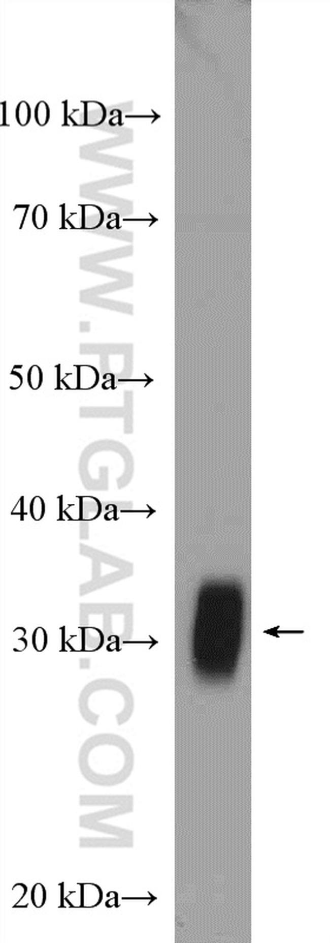 FHL1 Antibody in Western Blot (WB)