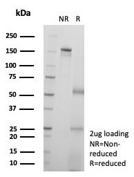 KIF2C (Kinesin Family Member 2C)/MCAK Antibody in SDS-PAGE (SDS-PAGE)