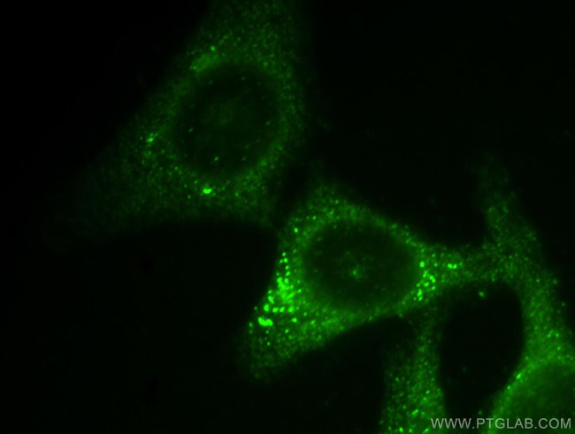 Midkine Antibody in Immunocytochemistry (ICC/IF)