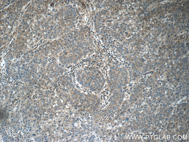 Midkine Antibody in Immunohistochemistry (Paraffin) (IHC (P))