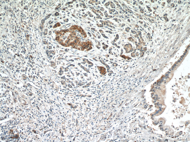 Midkine Antibody in Immunohistochemistry (Paraffin) (IHC (P))