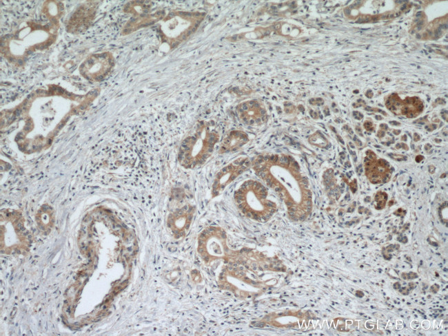 Midkine Antibody in Immunohistochemistry (Paraffin) (IHC (P))