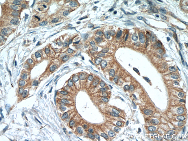 Midkine Antibody in Immunohistochemistry (Paraffin) (IHC (P))