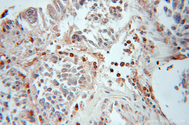 GABARAPL1 Antibody in Immunohistochemistry (Paraffin) (IHC (P))