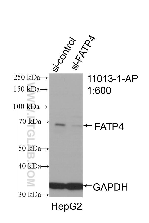 FATP4 Antibody in Western Blot (WB)