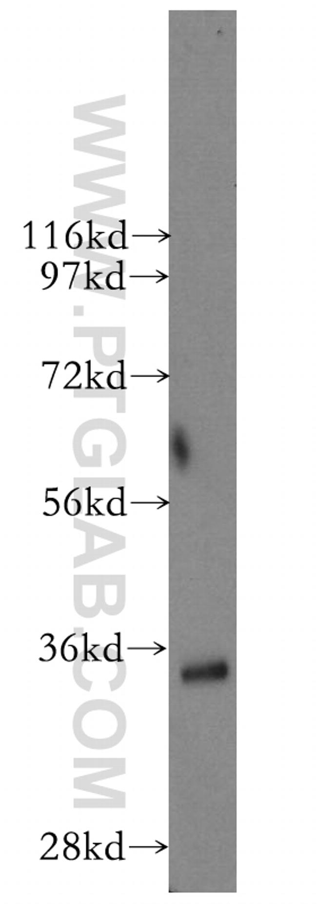 SGTA Antibody in Western Blot (WB)