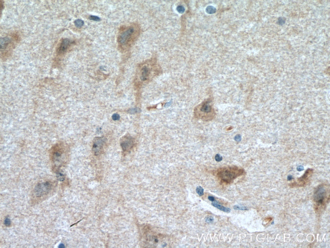 RAB33A Antibody in Immunohistochemistry (Paraffin) (IHC (P))