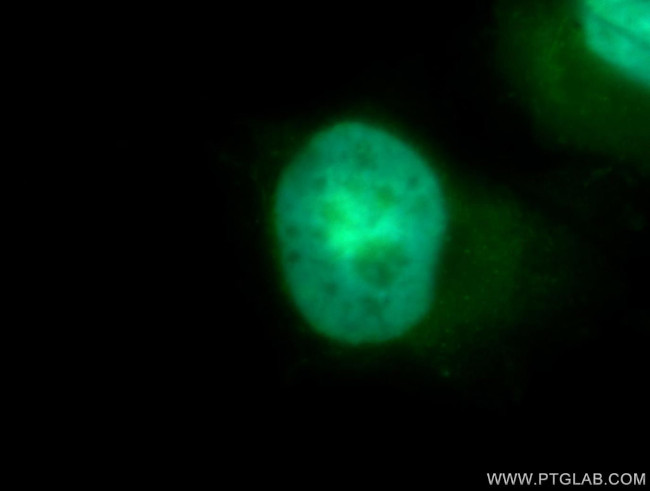 CDK4 Antibody in Immunocytochemistry (ICC/IF)