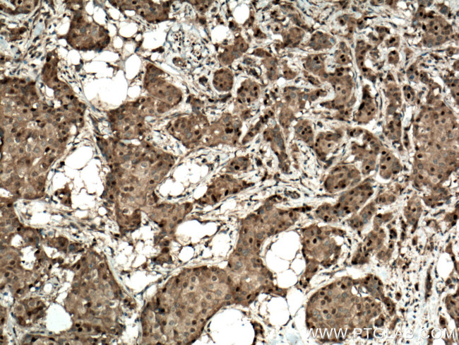 CDK4 Antibody in Immunohistochemistry (Paraffin) (IHC (P))