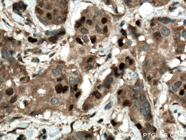 CDK4 Antibody in Immunohistochemistry (Paraffin) (IHC (P))