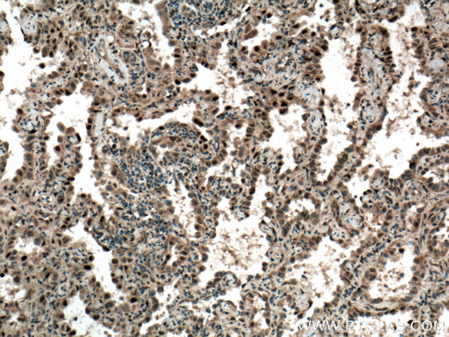 CDK4 Antibody in Immunohistochemistry (Paraffin) (IHC (P))