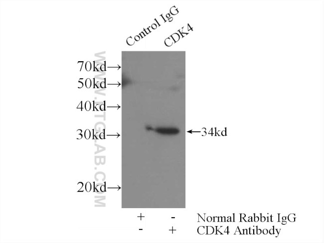 CDK4 Antibody in Immunoprecipitation (IP)