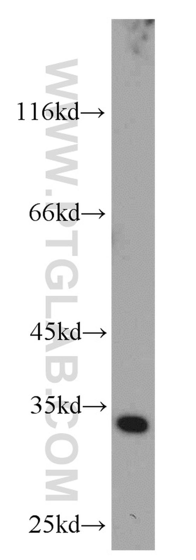 CDK4 Antibody in Western Blot (WB)