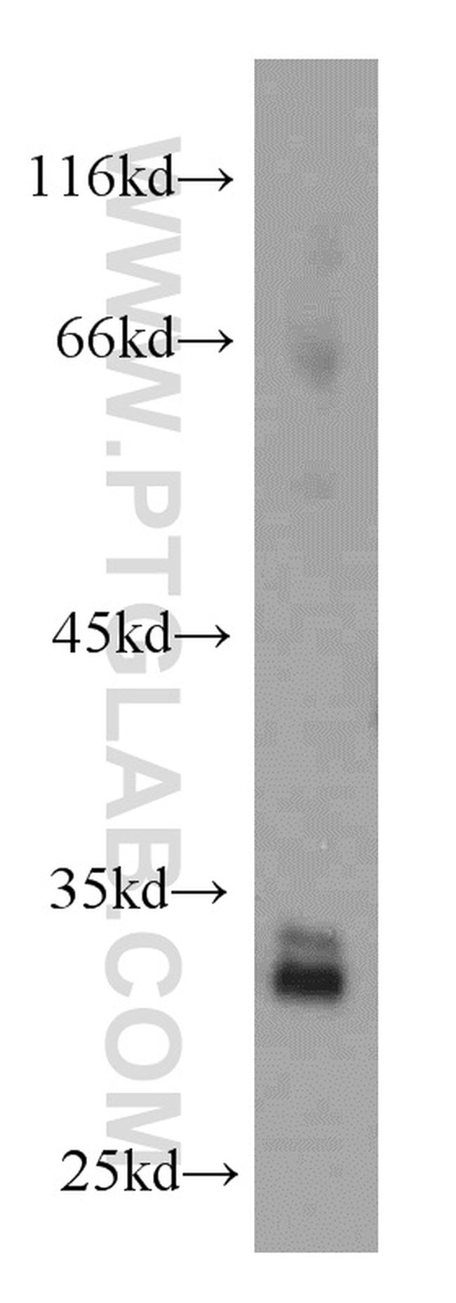 CDK4 Antibody in Western Blot (WB)