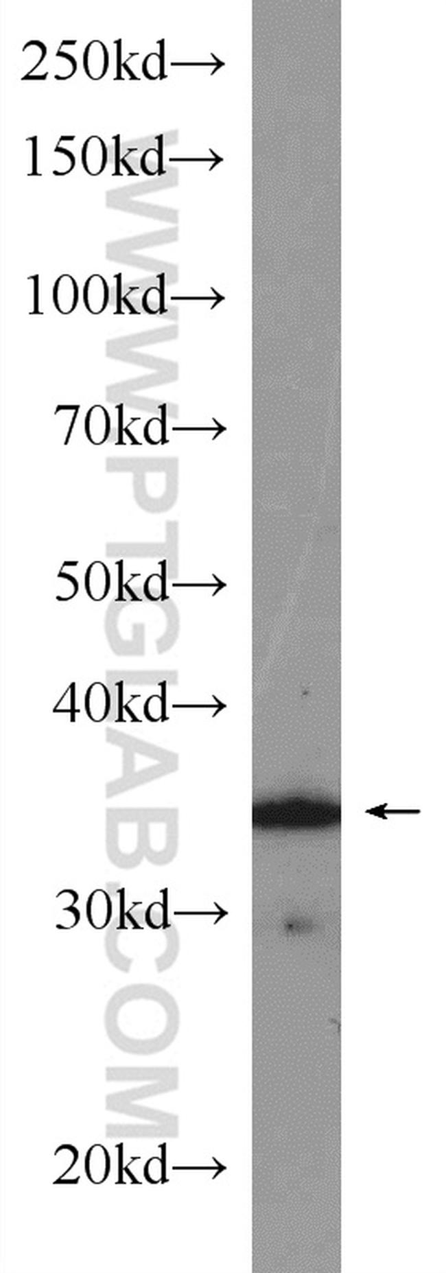 CDK4 Antibody in Western Blot (WB)