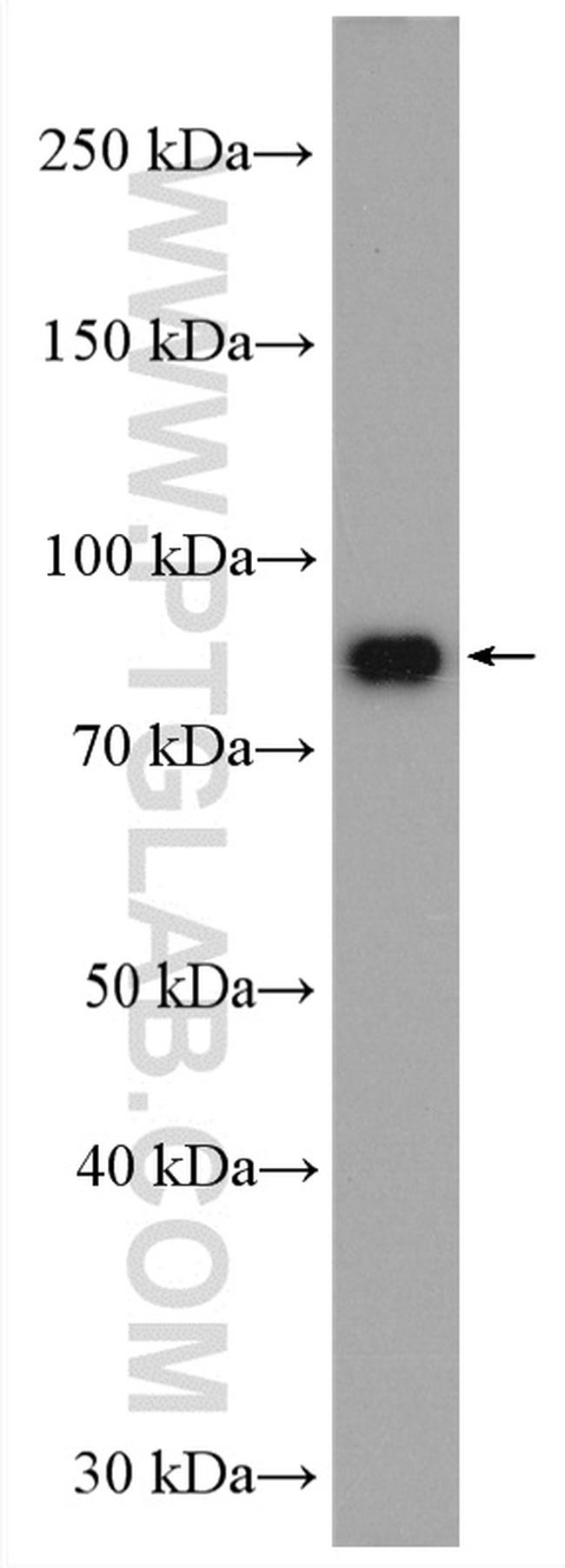 PLOD3 Antibody in Western Blot (WB)