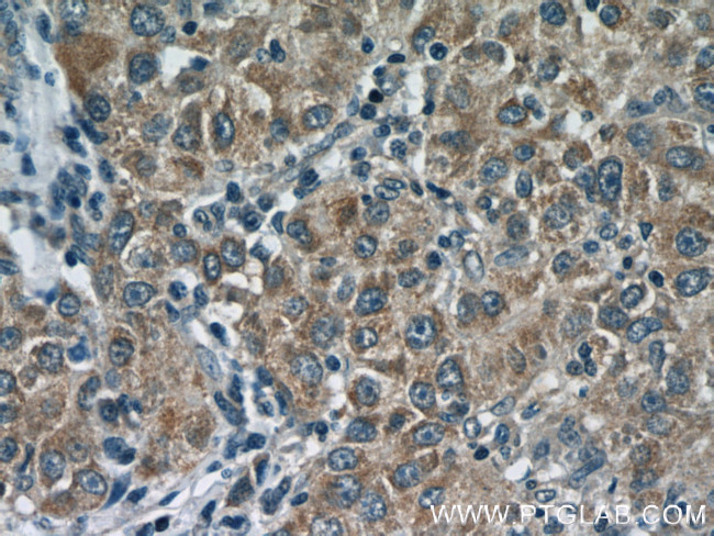 Glutamine synthetase Antibody in Immunohistochemistry (Paraffin) (IHC (P))