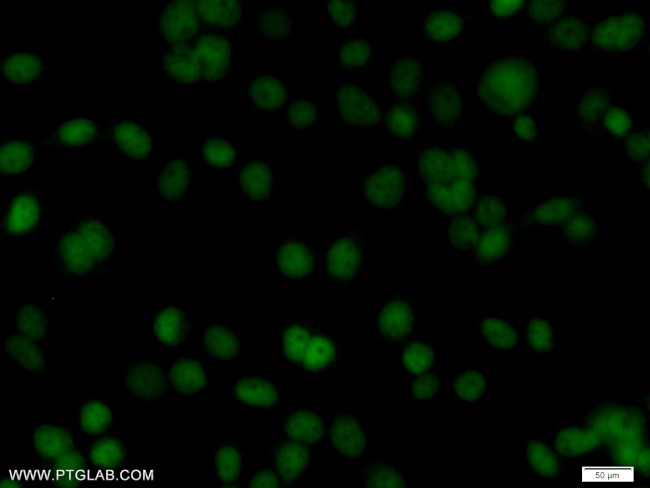 Transketolase Antibody in Immunocytochemistry (ICC/IF)