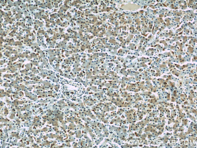 Transketolase Antibody in Immunohistochemistry (Paraffin) (IHC (P))