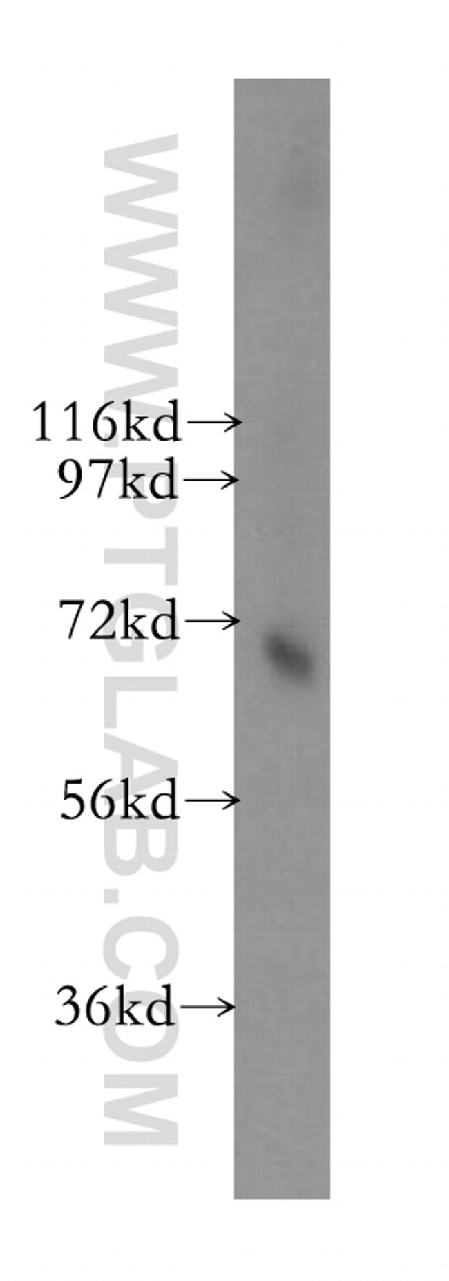 Transketolase Antibody in Western Blot (WB)