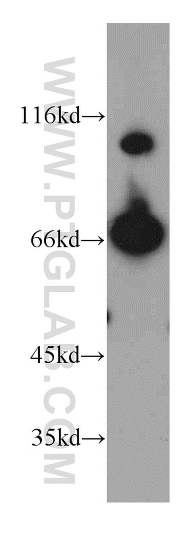 Transketolase Antibody in Western Blot (WB)