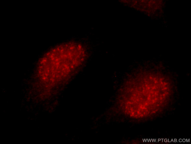 SYCE1 Antibody in Immunocytochemistry (ICC/IF)