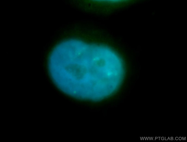 SYCE1 Antibody in Immunocytochemistry (ICC/IF)