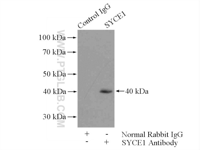 SYCE1 Antibody in Immunoprecipitation (IP)