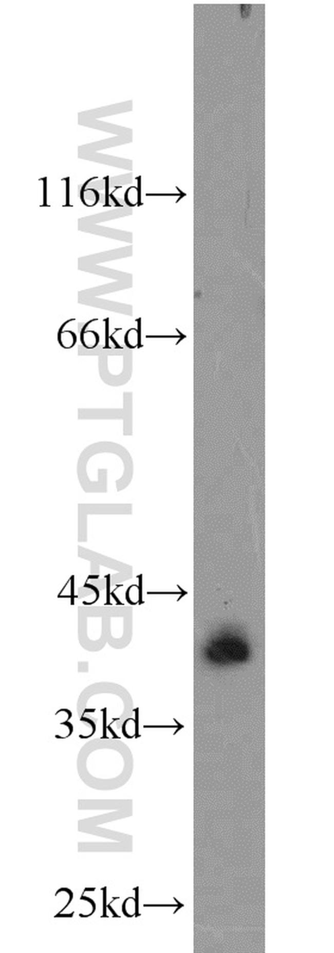 SYCE1 Antibody in Western Blot (WB)