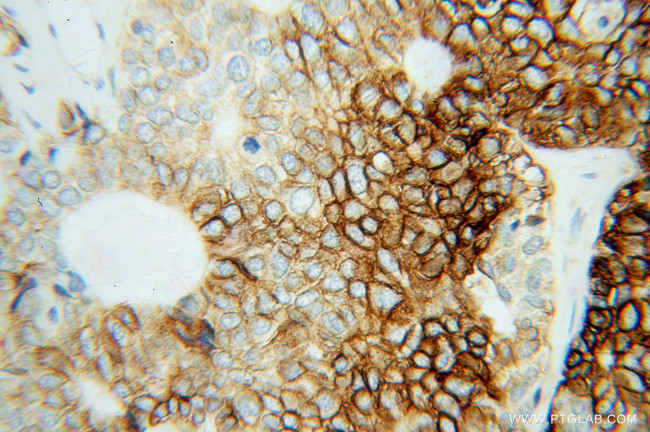 CA9 Antibody in Immunohistochemistry (Paraffin) (IHC (P))