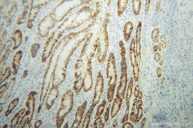 CA9 Antibody in Immunohistochemistry (Paraffin) (IHC (P))