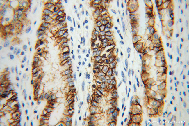 CA9 Antibody in Immunohistochemistry (Paraffin) (IHC (P))