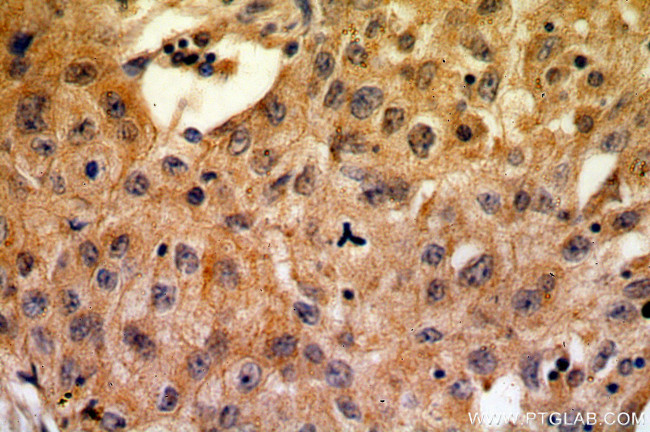 CA9 Antibody in Immunohistochemistry (Paraffin) (IHC (P))