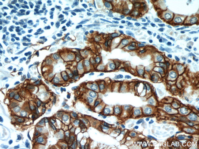 CA9 Antibody in Immunohistochemistry (Paraffin) (IHC (P))