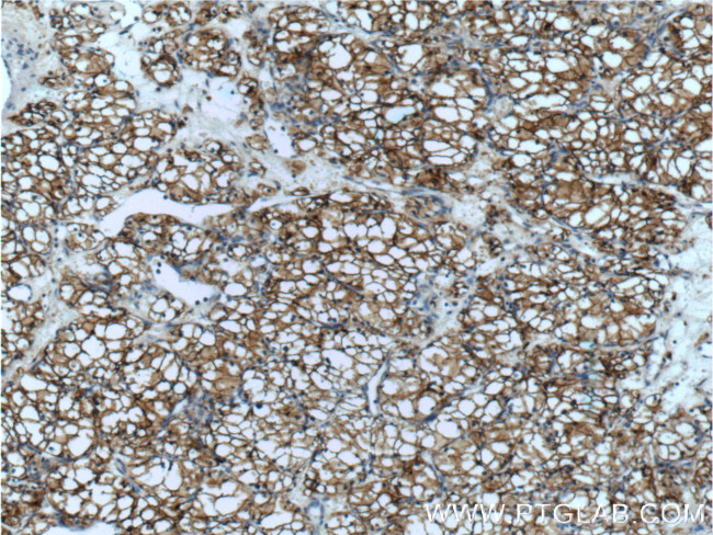 CA9 Antibody in Immunohistochemistry (Paraffin) (IHC (P))