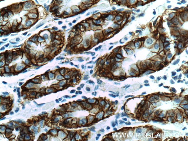 CA9 Antibody in Immunohistochemistry (Paraffin) (IHC (P))