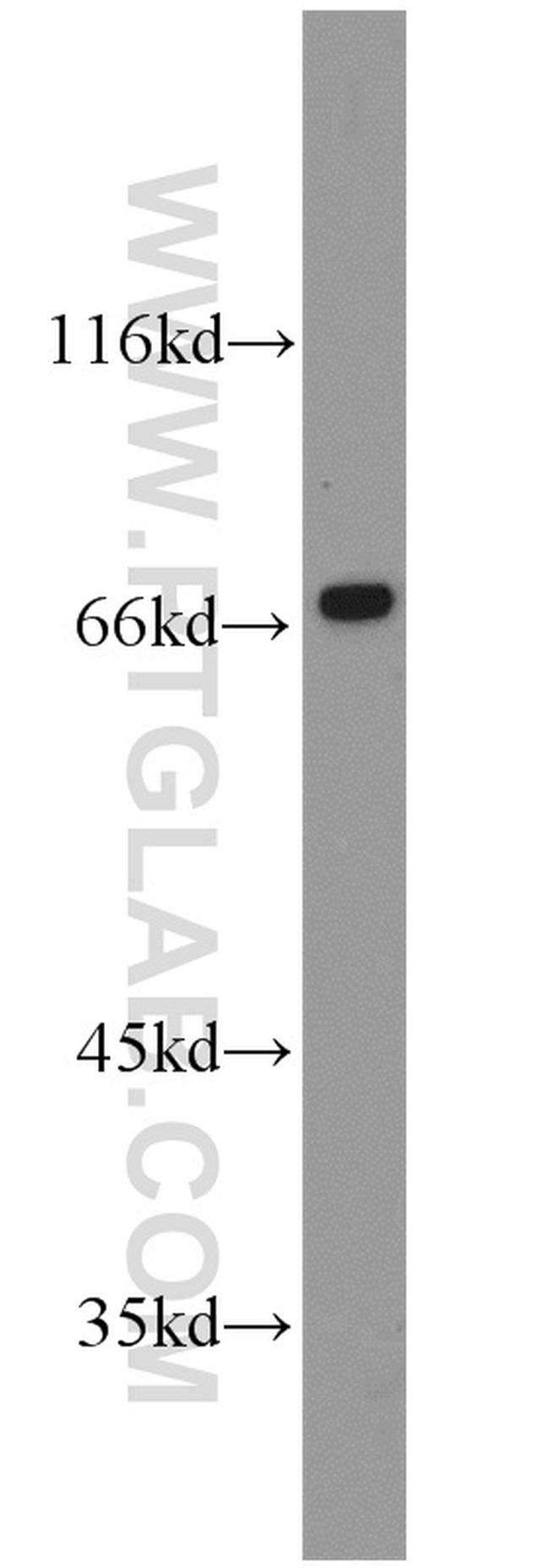 CA9 Antibody in Western Blot (WB)