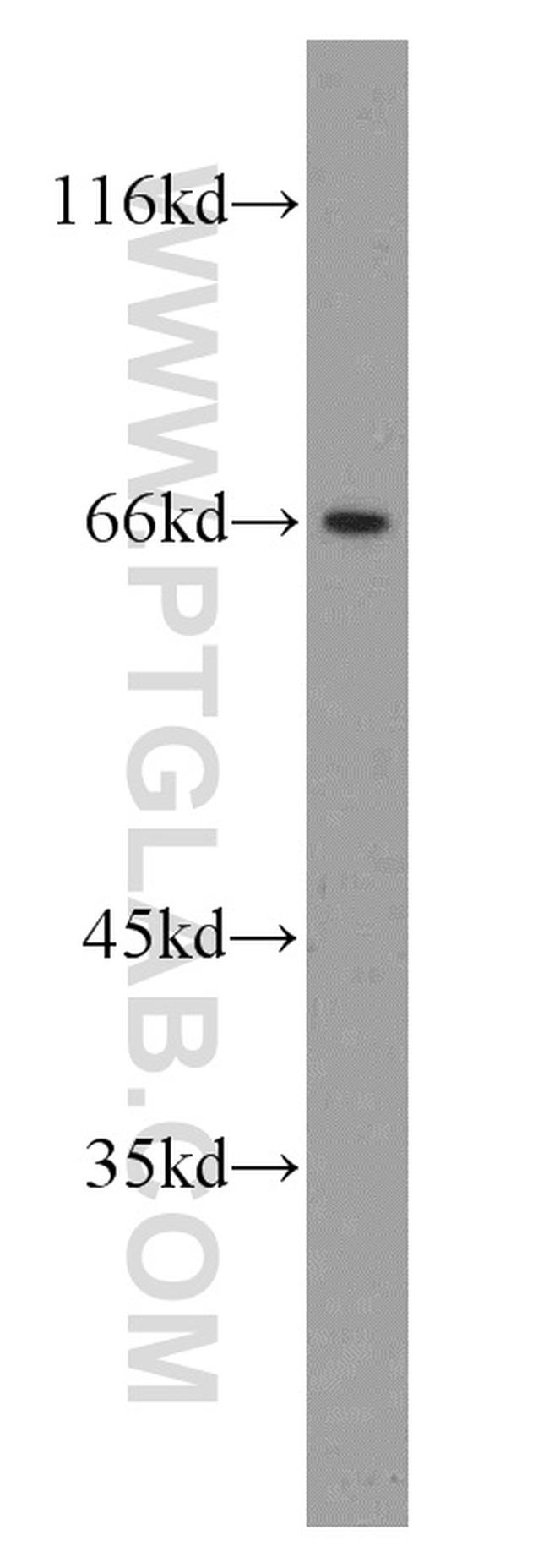 CA9 Antibody in Western Blot (WB)