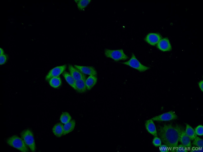 BORIS Antibody in Immunocytochemistry (ICC/IF)