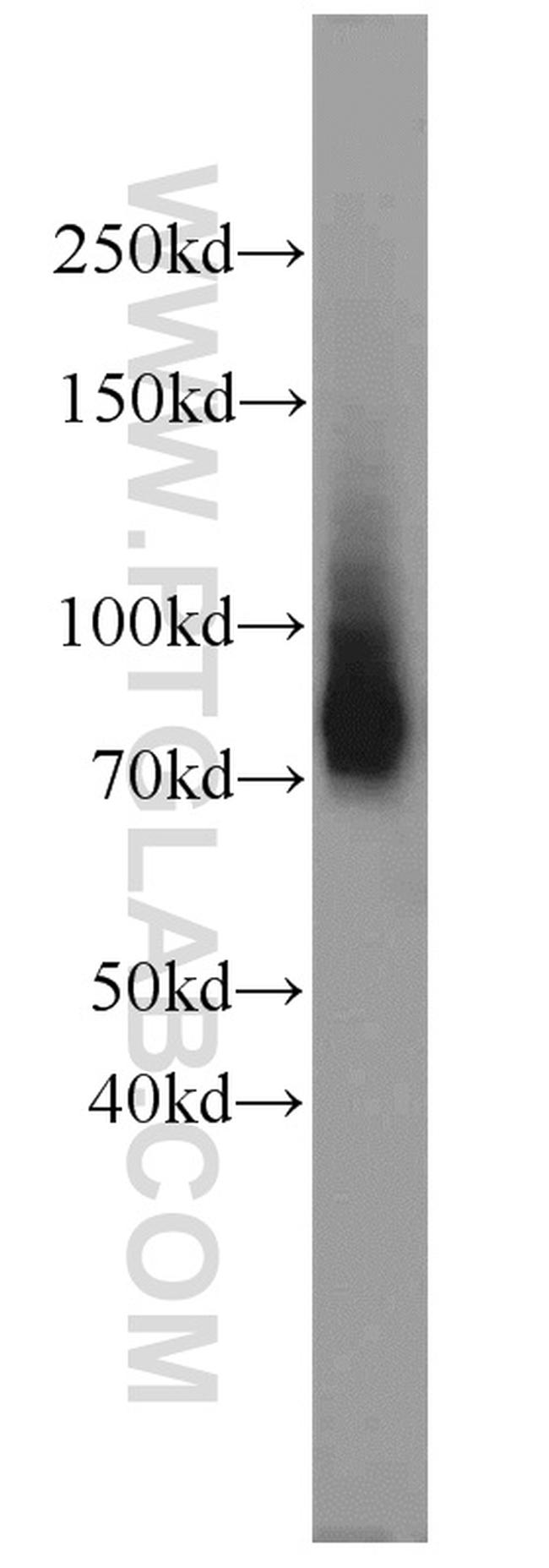 BORIS Antibody in Western Blot (WB)