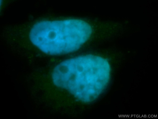 BORIS Antibody in Immunocytochemistry (ICC/IF)