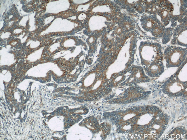 UCP2 Antibody in Immunohistochemistry (Paraffin) (IHC (P))