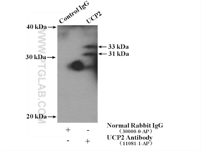 UCP2 Antibody in Immunoprecipitation (IP)